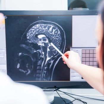 Why It's Important to Take Brain Injuries Seriously | Salpeter Gitkin Law Firm