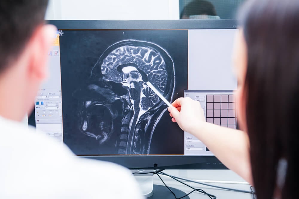 Why It's Important to Take Brain Injuries Seriously | Salpeter Gitkin Law Firm